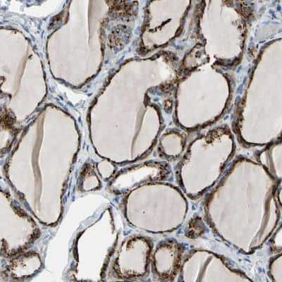 Immunohistochemistry-Paraffin: Retinol Saturase Antibody [NBP1-92325]