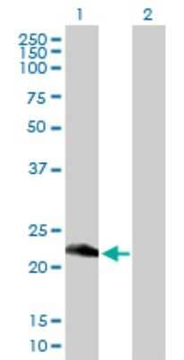 Western Blot: Retinol Saturase Antibody [H00054884-B01P]