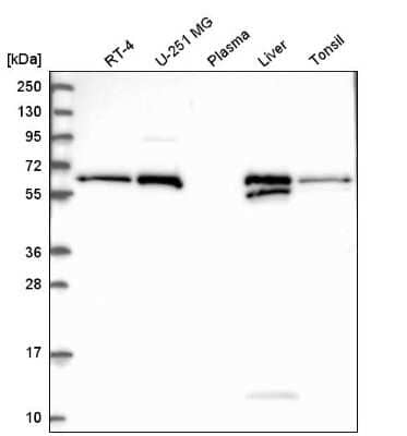 Western Blot: Retinol Saturase Antibody [NBP2-58103]