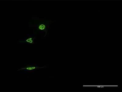 Immunocytochemistry/ Immunofluorescence: Rev-erb A alpha/NR1D1 Antibody (1F4) [H00009572-M16]