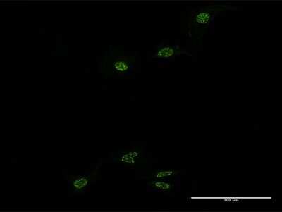 Immunocytochemistry/ Immunofluorescence: Rev-erb A alpha/NR1D1 Antibody (2G6) [H00009572-M15]