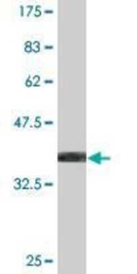 Western Blot: Rev-erb A alpha/NR1D1 Antibody (2G6) [H00009572-M15]