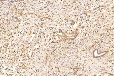 Immunohistochemistry-Paraffin: Rev-erb A alpha/NR1D1 Antibody (4F6) [H00009572-M02]