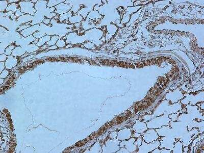 Immunohistochemistry-Paraffin: Rev-erb A alpha/NR1D1 Antibody (4F6) [H00009572-M02]