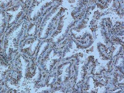 Immunohistochemistry-Paraffin: Rev-erb A alpha/NR1D1 Antibody (4F6) [H00009572-M02]