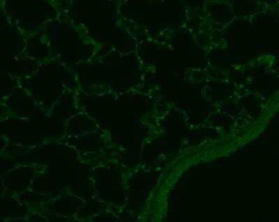 Immunohistochemistry-Paraffin: Rev-erb A alpha/NR1D1 Antibody (4F6) [H00009572-M02]
