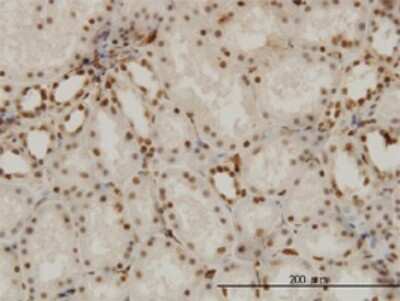 Immunohistochemistry-Paraffin: Rev-erb A alpha/NR1D1 Antibody (4F6) [H00009572-M02]
