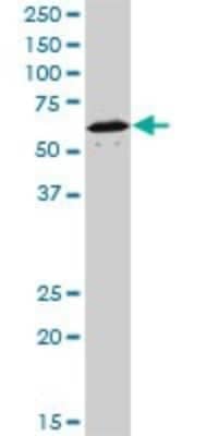 Western Blot: Rev-erb A alpha/NR1D1 Antibody (4F6) [H00009572-M02]