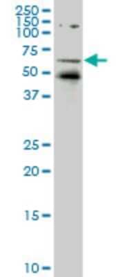 Western Blot: Rev-erb A alpha/NR1D1 Antibody (5H6) [H00009572-M05]