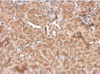 Immunohistochemistry-Paraffin: Rev-erb A alpha/NR1D1 Antibody [NBP2-19574]