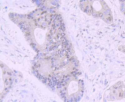 Immunohistochemistry-Paraffin: Rev-erb A alpha/NR1D1 Antibody (JU34-31) [NBP2-75645]