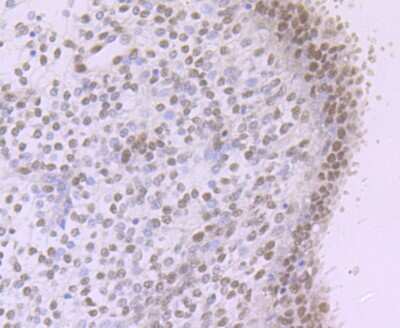 Immunohistochemistry-Paraffin: Rev-erb A alpha/NR1D1 Antibody (JU34-31) [NBP2-75645]