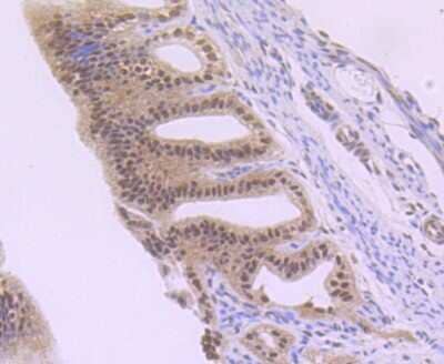 Immunohistochemistry-Paraffin: Rev-erb A alpha/NR1D1 Antibody (JU34-31) [NBP2-75645]