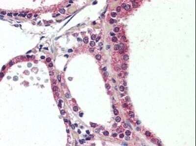 Immunohistochemistry-Paraffin: Rev-erb beta/NR1D2 Antibody - BSA Free [NBP1-50165]