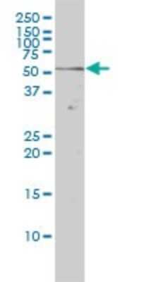 Western Blot: Rev-erb beta/NR1D2 Antibody (1G2) [H00009975-M01]