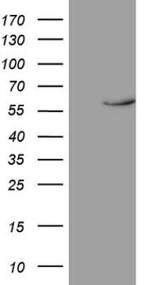 Western Blot: Rev-erb beta/NR1D2 Antibody (OTI5E10) [NBP2-46219]