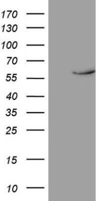 Western Blot: Rev-erb beta/NR1D2 Antibody (OTI5E10)Azide and BSA Free [NBP2-73854]