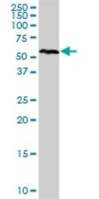 Western Blot: Rev-erb beta/NR1D2 Antibody [H00009975-D01P]