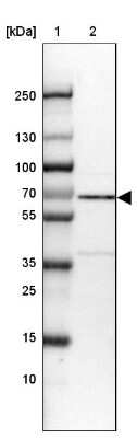 Western Blot: Rev-erb beta/NR1D2 Antibody [NBP2-47306]