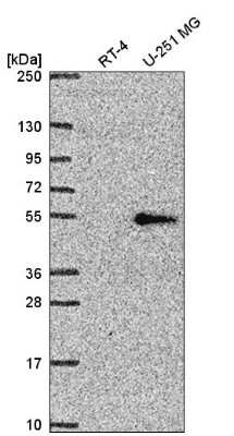 Western Blot: Rev-erb beta/NR1D2 Antibody [NBP2-56141]