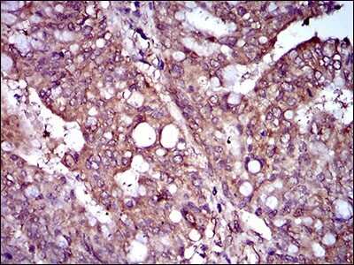 Immunohistochemistry: Rex-1/ZFP42 Antibody (5E11E7) - BSA Free [NBP2-37360]