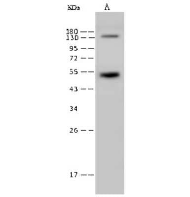 Western Blot: Rex-1/ZFP42 Antibody [NBP2-99539]