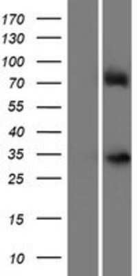 Western Blot: Rex-1/ZFP42 Overexpression Lysate [NBP2-05092]