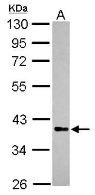 Western Blot: Rffl Antibody [NBP2-20137]