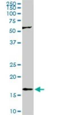 Western Blot: Rheb Antibody (2C11) [H00006009-M01]
