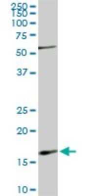 Western Blot: Rheb Antibody (2C11) [H00006009-M01]