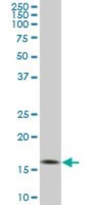 Western Blot: Rheb Antibody (2C11) [H00006009-M01]