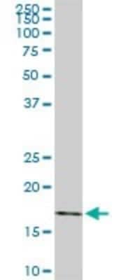 Western Blot: Rheb Antibody (2C11) [H00006009-M01]