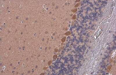 Immunohistochemistry-Paraffin: Rheb Antibody (GT39810) [NBP3-13608]
