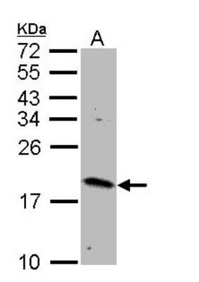 Western Blot: Rheb Antibody [NBP1-31630]