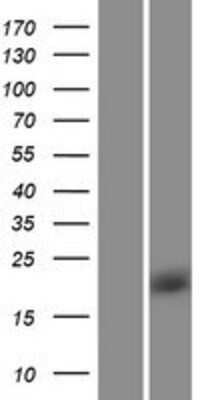 Western Blot: Rheb Overexpression Lysate [NBP2-07725]