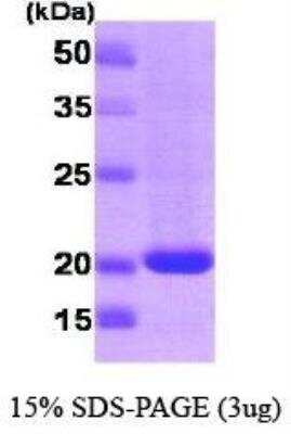 SDS-PAGE: Recombinant Human Rheb T7 Protein [NBC1-18435]