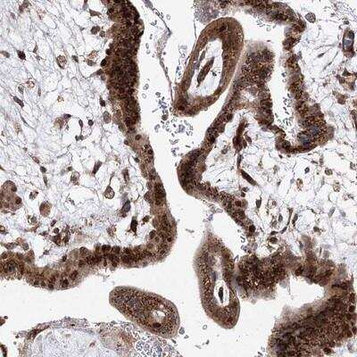 Immunohistochemistry-Paraffin: Rho GTPase activating protein 31 Antibody [NBP1-90644]