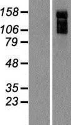 Western Blot: Rho GTPase activating protein 31 Overexpression Lysate [NBP2-06622]