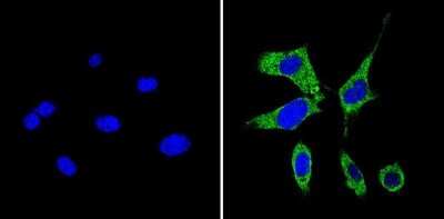 Immunocytochemistry/ Immunofluorescence: RhoA Antibody (1A11-4G10) [NBP2-22528]