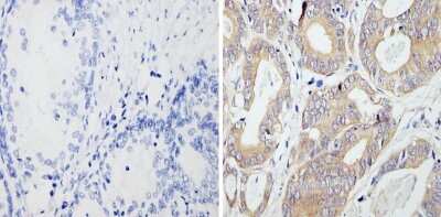 Immunohistochemistry-Paraffin: RhoA Antibody (1A11-4G10) [NBP2-22528]