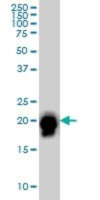 Western Blot: RhoA Antibody (1A11) [H00000387-M03]