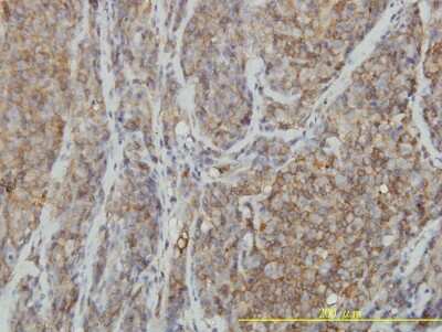 Immunohistochemistry-Paraffin: RhoA Antibody (1B12) [H00000387-M04]