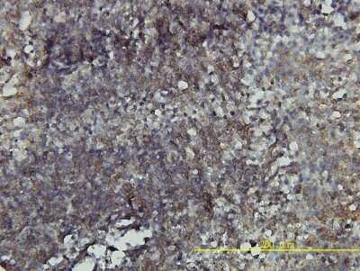 Immunohistochemistry-Paraffin: RhoA Antibody (1C1) [H00000387-M05]