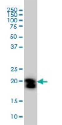 Western Blot: RhoA Antibody (1C1) [H00000387-M05]
