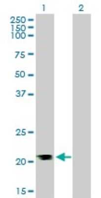 Western Blot: RhoA Antibody (1C1) [H00000387-M05]