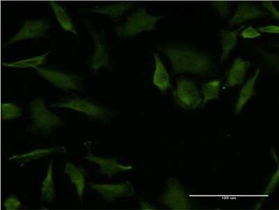 Immunocytochemistry/ Immunofluorescence: RhoA Antibody (1C3) [H00000387-M08]