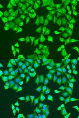 Immunocytochemistry/ Immunofluorescence: RhoA Antibody - BSA Free [NBP3-15485]