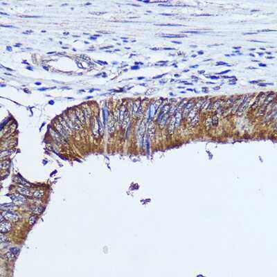 Immunohistochemistry-Paraffin: RhoA Antibody - BSA Free [NBP3-15485]