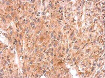 Immunohistochemistry-Paraffin: RhoB Antibody [NBP2-20154]