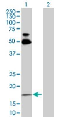 Western Blot: RhoB Antibody [H00000388-D01P]